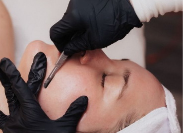 Dermaplaning